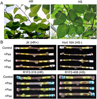 Transcriptome analysis revealed that AcWRKY75 transcription factor reduced the resistance of kiwifruit to Pseudomonas syringae pv. actinidiae